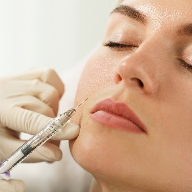 dermal-fillers-treatment