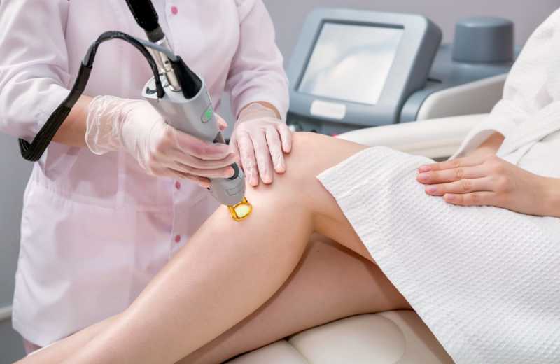 full body laser hair removal
